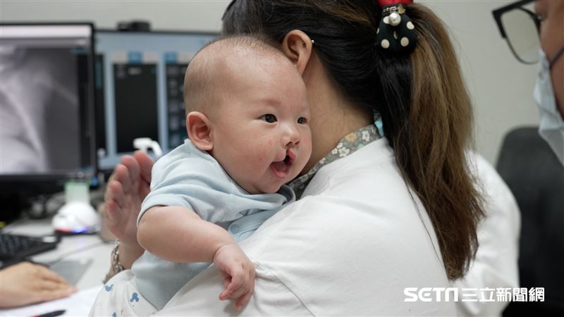 【三立新聞】從心出發／懷上唇腭裂寶寶…母問：會怪我生下他嗎　資深醫回答催淚