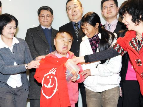 【TAIPEI TIMES】Chinese girl visits Taiwan for sixth craniofacial operation