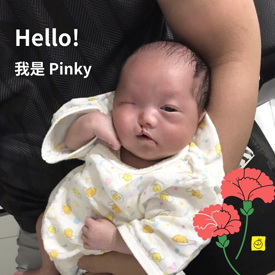 顱顏寶寶Pinky的故事溫暖你的心